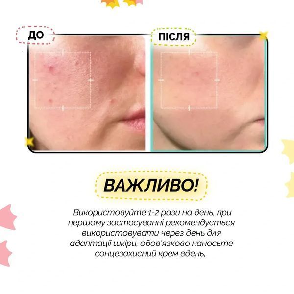 Заспокійлива сироватка з азелаїновою кислотою 16% Medicube Azelaic Acid 16 BB Calming Serum 8800289479083  фото