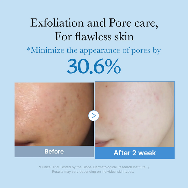 Увлажняющий тонер по уходу за расширенными порами Medicube Zero Pore Toner, 250ml 8800256115167 фото